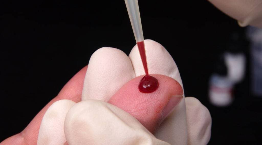 લોહી જાડુ થવા પાછળ આ પાંચ કારણો છે જવાબદાર, શરીરની થઈ જાય છે આવી ખરાબ હાલત