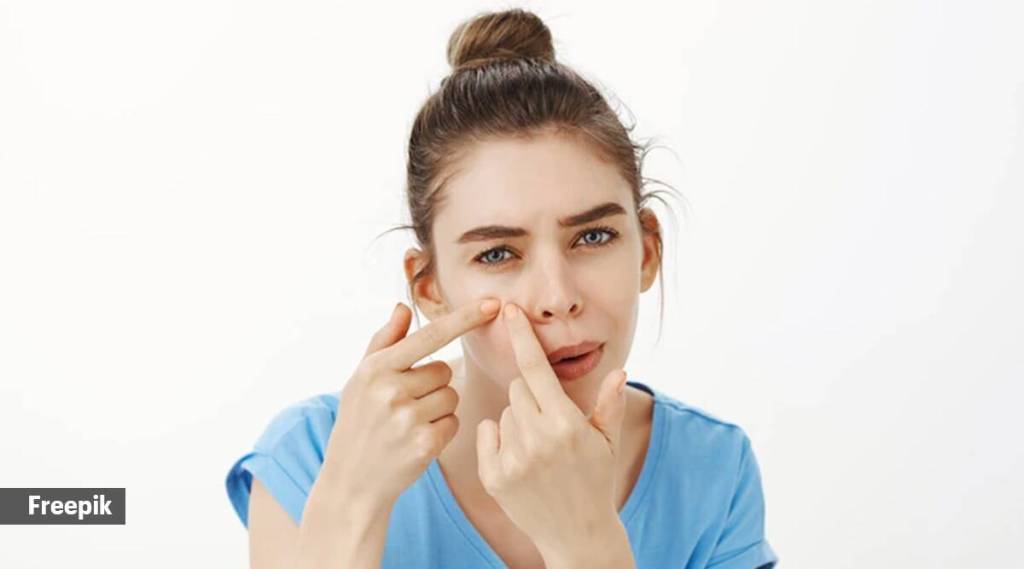 Blind pimples: બ્લાઇન્ડ પીમ્પલ શું છે અને તેની સારવાર કેવી રીતે કરવી?