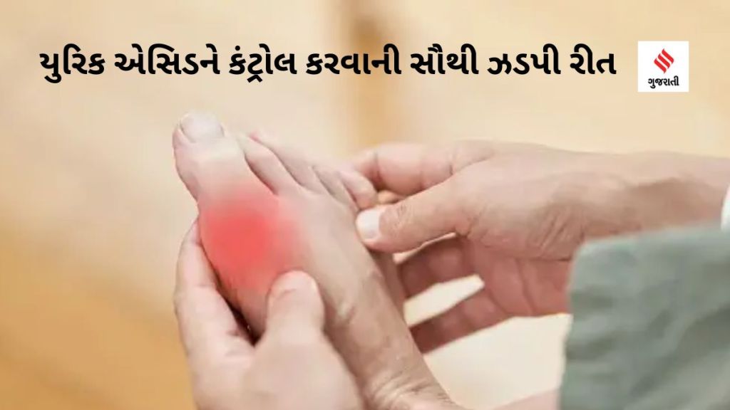 Uric Acid Treatment: યુરિક એસિડને કંટ્રોલ કરવાની સૌથી ઝડપી રીત, સાંધાના દુખાવાથી રાહત આપશે, સંધિવા અને પથરીથી પણ બચાવશે. Uric Acid Treatment: યુરિક એસિડને કંટ્રોલ કરવાની સૌથી ઝડપી રીત, સાંધાના દુખાવાથી રાહત આપશે, સંધિવા અને પથરીથી પણ બચાવશે.