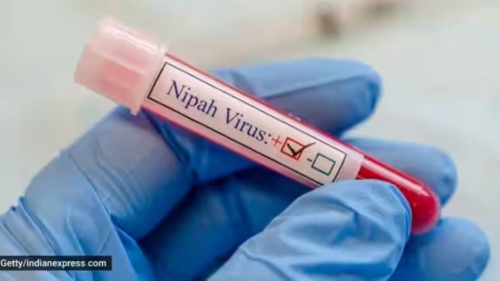 Nipah Virus : કોરોનાથી વધારે ખતરનાક છે નિપાહ વાયરસ, દર્દીના મોતની 70 ટકા શક્યતા; ICMRની ચેતવણી