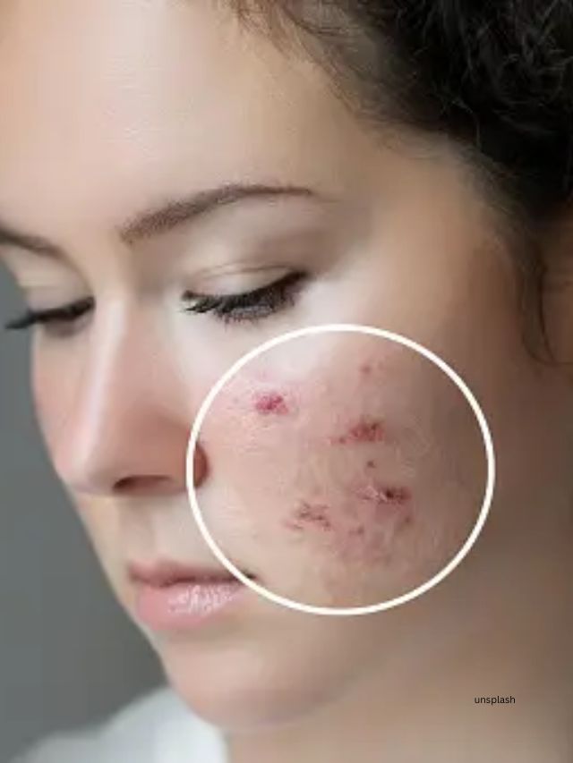 Skincare Tips : ફેસ પરથી ડાઘ દૂર કરવામાં મદદગાર થશે આ દેશી નુસખા