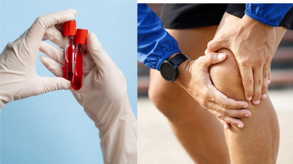 Blood Circulation : શરીરમાં ખરાબ બ્લડ સર્ક્યુલેશનના 5 લક્ષણો, જો અવગણશો તો ગંભીર બીમારીના ભોગ બનશો