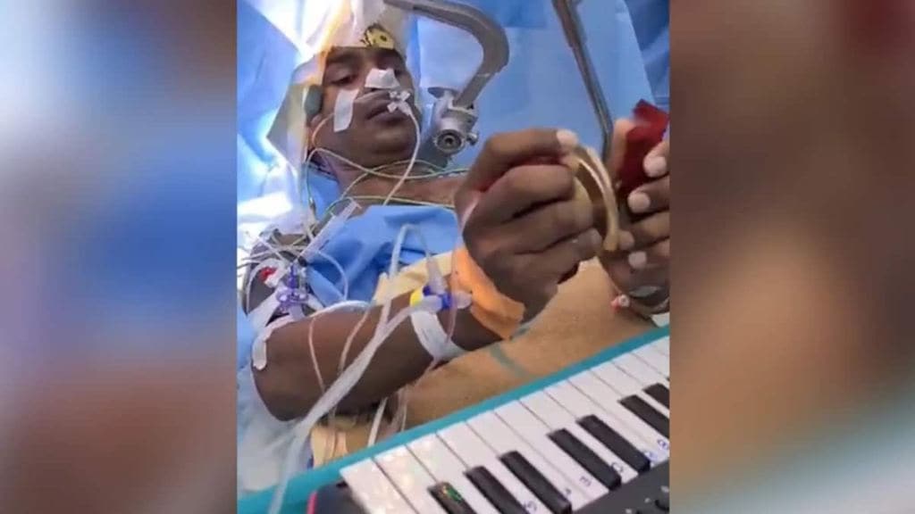 OMG! ડોકટરો સર્જરી માટે મગજ ખોલીને બેઠા હતા, તો દર્દી હનુમાન ચાલીસા ગાતો રહ્યો અને પિયાનો વગાડતો રહ્યો