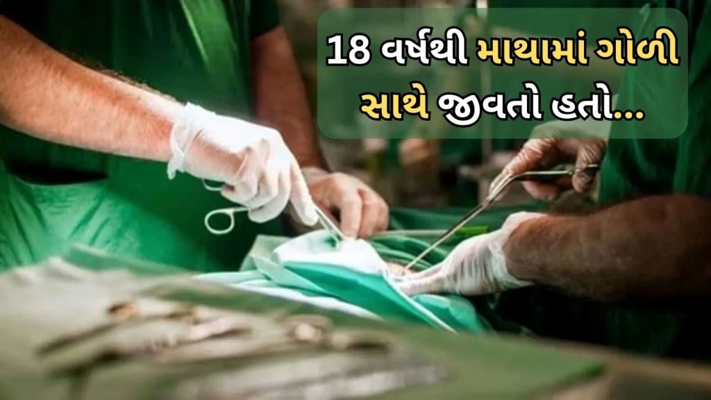 18 વર્ષથી માથામાં ફસાયેલી હતી ગોળી, બેંગલુરુના ડોક્ટરોએ યમનથી આવેલા વ્યક્તિનો જીવ બચાવવા કરી સર્જરી