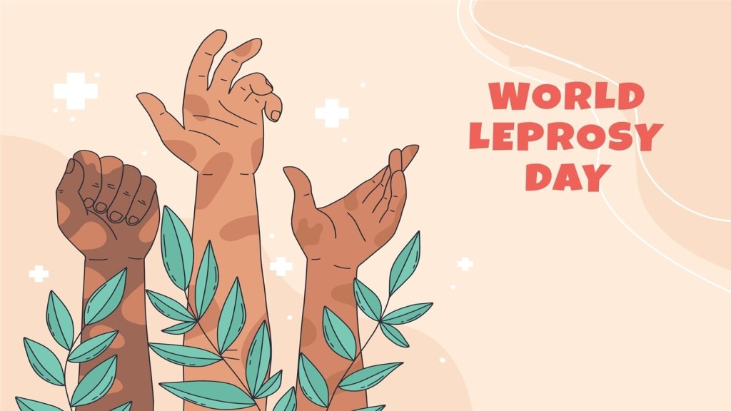 World Leprosy Day: વર્લ્ડ લેપ્રસી ડે, રક્તપિત્ત બદનામ છે એટલો ચેપી નથી, જાણો બધું