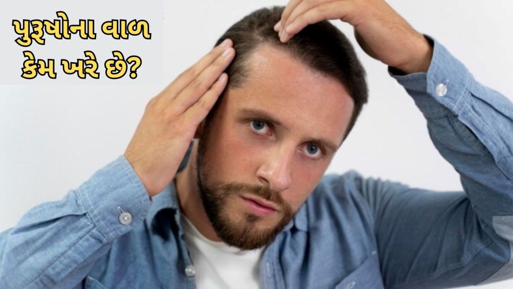 પુરુષોમાં વાળ ખરવાના અને ટાલ પડવાના આ 9 કારણો છે, આજે જ કરો ઉપાય, ફરી વાળ ભરાવદાર થઈ જશે
