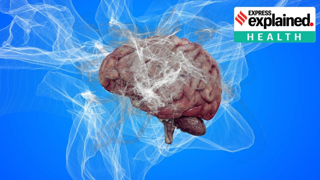 Science | વિજ્ઞાન : વૈજ્ઞાનિકો નવી અલ્ઝાઈમર દવાને આપે છે સમર્થન: જોઈએ તેના ફાયદા વિ જોખમો Science | વિજ્ઞાન : વૈજ્ઞાનિકો નવી અલ્ઝાઈમર દવાને આપે છે સમર્થન: જોઈએ તેના ફાયદા વિ જોખમો