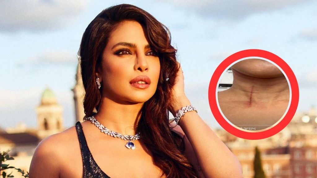 Priyanka Chopra Injured: પ્રિયંકા ચોપરાનો જીવ બચ્યો, ગળાના ભાગે તલવાર વાગી, ચાહકો ચિંતિત