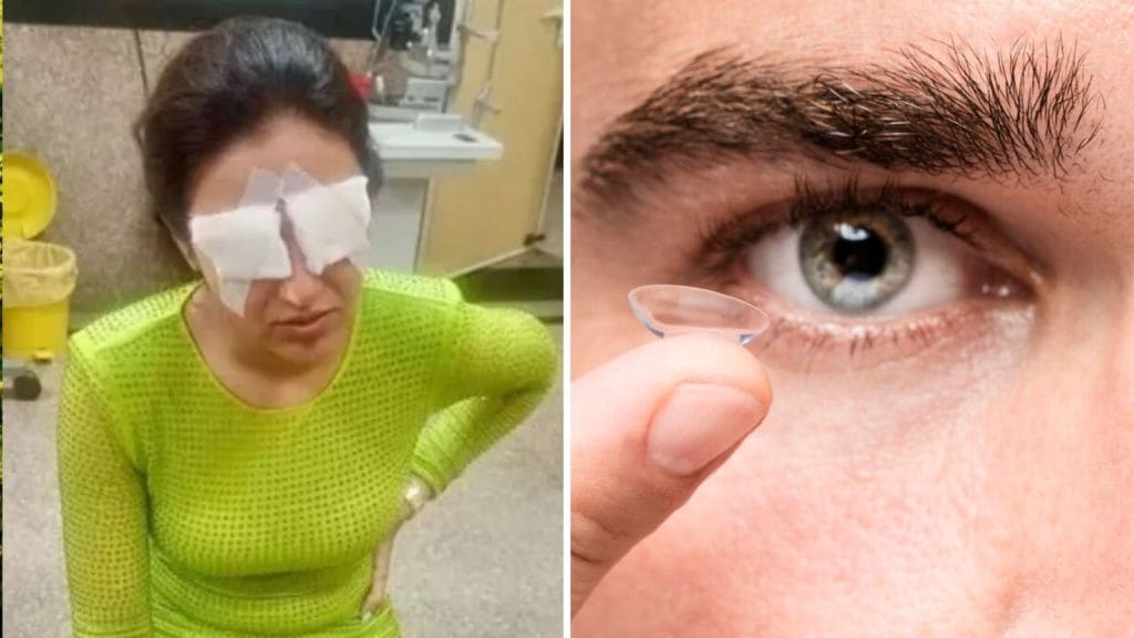 Contact Lens Tips: કોન્ટેક્ટ લેન્સ થી જસ્મિન ભસીનને આંખને નુકસાન, કોન્ટેક્ટ લેન્સ પહેરતી વખતે આટલી કાળજી રાખવી Contact Lens Tips: કોન્ટેક્ટ લેન્સ થી જસ્મિન ભસીનને આંખને નુકસાન, કોન્ટેક્ટ લેન્સ પહેરતી વખતે આટલી કાળજી રાખવી