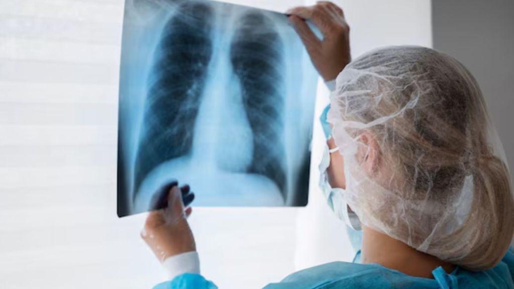 Lung Cancer In India