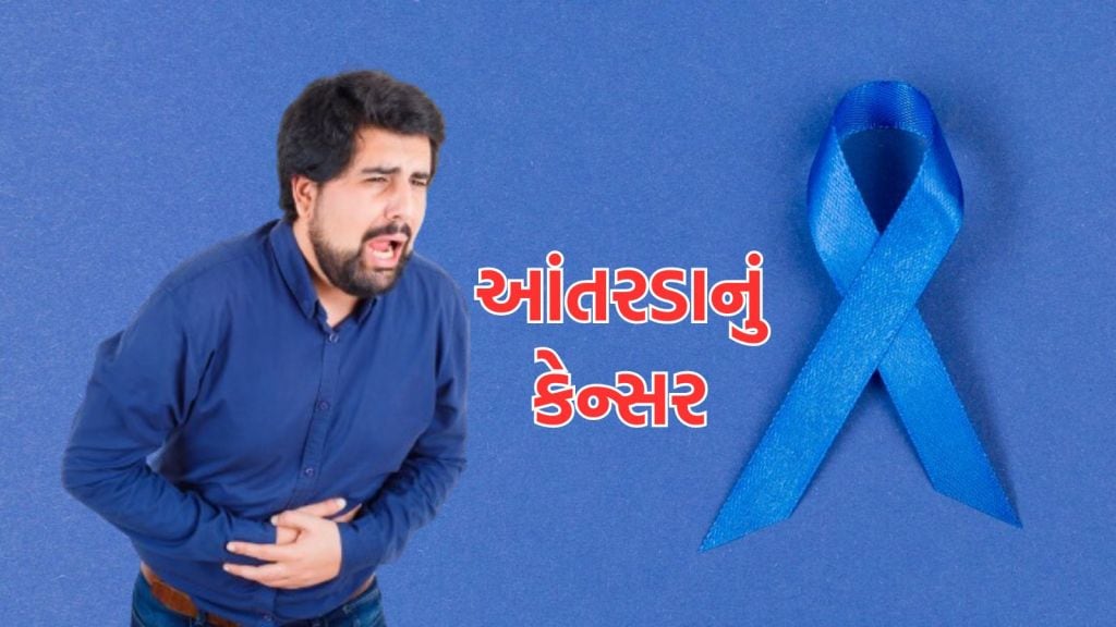 Colon Cancer: યુવાનોમાં કેમ વધી રહ્યું છે આંતરડાના કેન્સરનું જોખમ, સમયસર ઓળખી લો આ 5 લક્ષણ, મોટી મુશ્કેલીથી બચશો