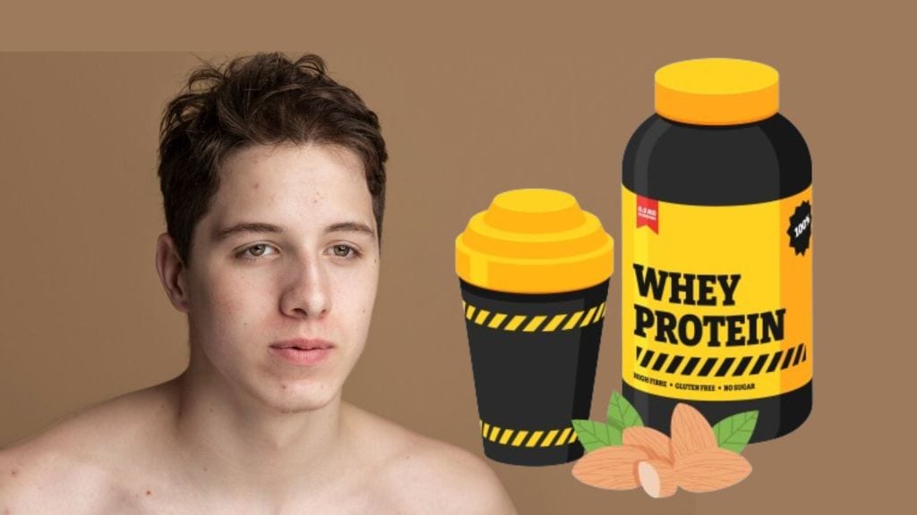 Whey Proteins: વે પ્રોટિન પીવાથી ખીલ થાય છે? સ્કીન ડોક્ટર પાસેથી જાણો ખીલ મટાડવાના ઉપાય