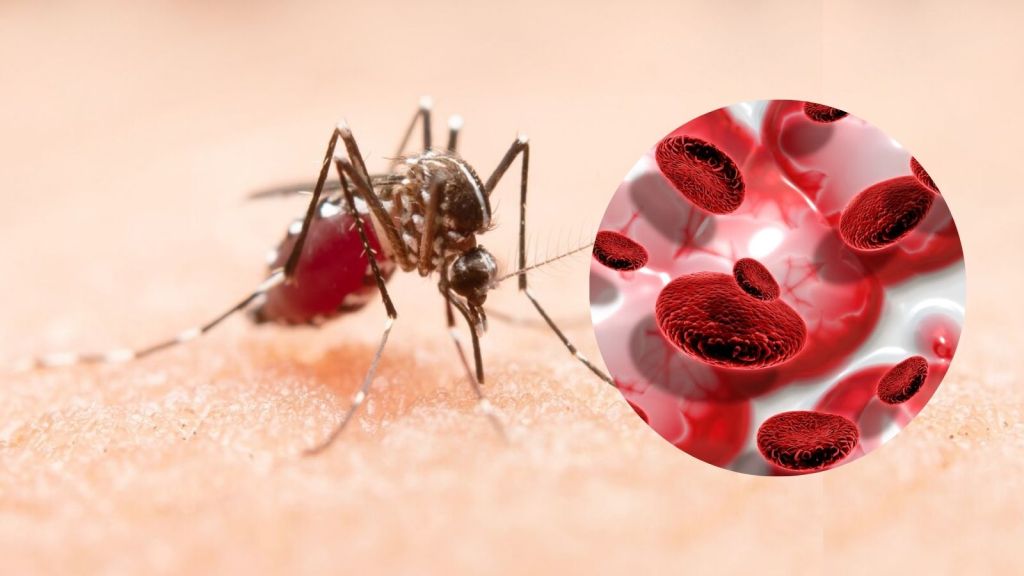 Health Tips For Dengue: ડેન્ગ્યુ થયો છે કે કેમ કેવી રીતે જાણવું? લોહીમાં પ્લેટ વધારવા માટે શું ખાવું? ડોક્ટર પાસેથી જાણો