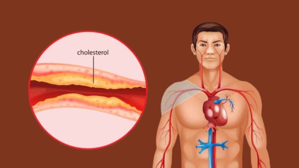 Cholesterol Levels Chart: કોલેસ્ટ્રોલ લેવલ ઉંમર મુજબ કેટલું હોવું જોઇએ? જુઓ ચાર્ટ