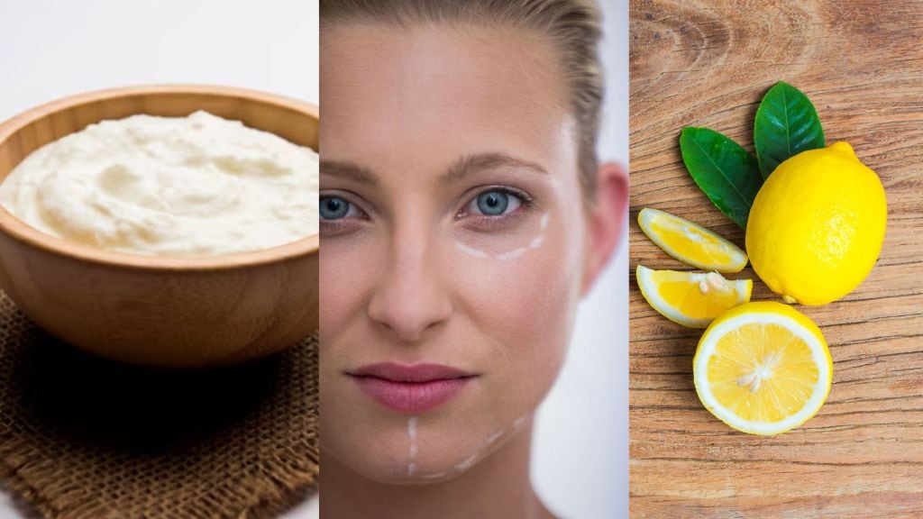 Dark circles | ડાર્ક સર્કલ દૂર કરશે લીંબુ અને દહીંનો ઉપયોગ, આ રીતે બનાવો માસ્ક Dark circles | ડાર્ક સર્કલ દૂર કરશે લીંબુ અને દહીંનો ઉપયોગ, આ રીતે બનાવો માસ્ક