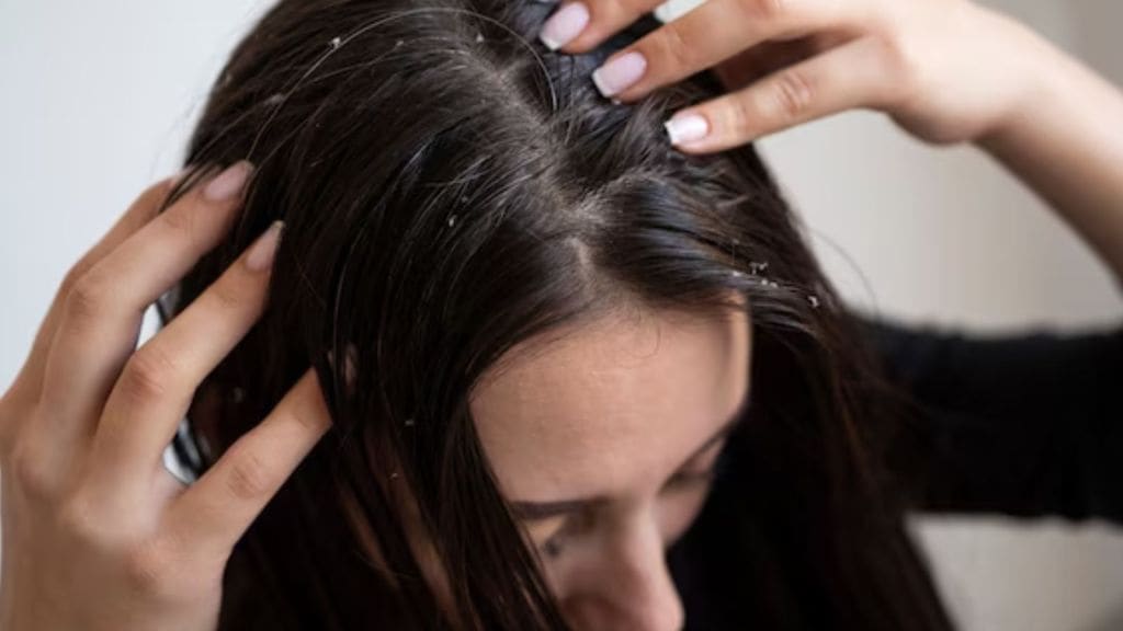 ખોડો દૂર કરવાના ઘરેલુ ઉપાય: હેર કેર માટે લીમડાના પાનનો આ રીતે ઉપયોગ કરો, વાળ પણ રહેશે મજબૂત! ખોડો દૂર કરવાના ઘરેલુ ઉપાય: હેર કેર માટે લીમડાના પાનનો આ રીતે ઉપયોગ કરો, વાળ પણ રહેશે મજબૂત!