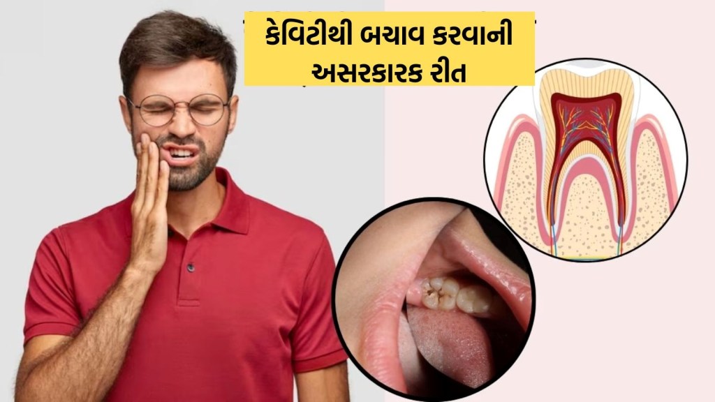 કેવિટી થી સડી શકે છે દાંત, આ ચાર રીતો છે રામબાણ ઇલાજ, બચી જશે દાંત