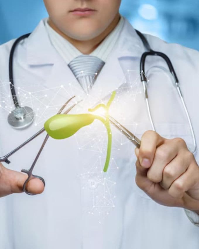 <strong>પિત્તાશય દૂર કરવામાં આવે તો શું થાય ? </strong>જ્યારે પિત્તાશય દૂર કરવામાં આવે છે (જેને કોલેસીસ્ટેક્ટોમી કહેવાય છે), ત્યારે યકૃત પિત્ત બનાવવાનું ચાલુ રાખે છે, પરંતુ પિત્ત હવે સીધું નાના આંતરડામાં ટપકતું રહે છે. આનો અર્થ એ છે કે હવે પિત્તનો સંગ્રહ થતો નથી, ફક્ત સતત પ્રવાહ રહે છે.