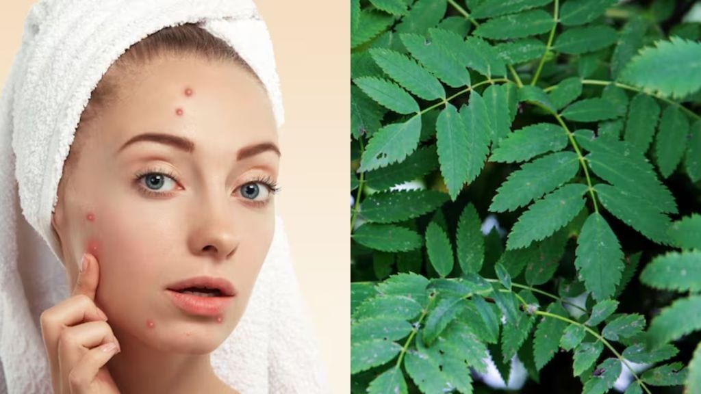 Navratri 2025 | ગરબા રમવા જતા પહેલા ખીલ અને ડાઘથી પરેશાન છો? લીમડાના પાનનો આ રીતે કરો ઉપયોગ