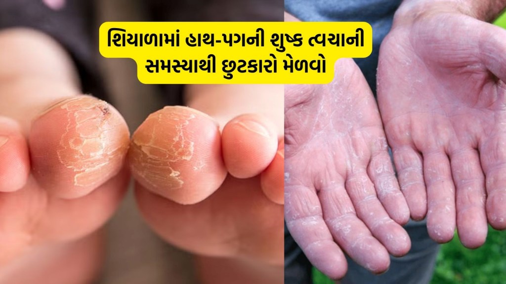 શું શિયાળામાં તમારા હાથ-પગ પણ ફાટી જાય છે, દાદી-નાનીના આ 5 નુસખા અજમાવો શું શિયાળામાં તમારા હાથ-પગ પણ ફાટી જાય છે, દાદી-નાનીના આ 5 નુસખા અજમાવો